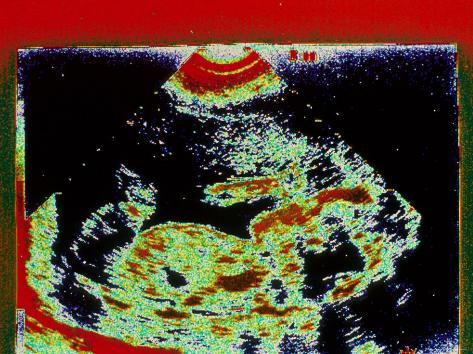 Zygote To Fetus