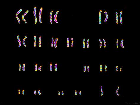 Karyotype Color Normal Female Child Photographic Print