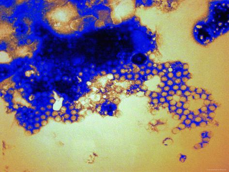 Stool Virus rotavirus from stool diarrhea virus intestinal Stool Virus rotavirus from stool diarrhea virus intestinal