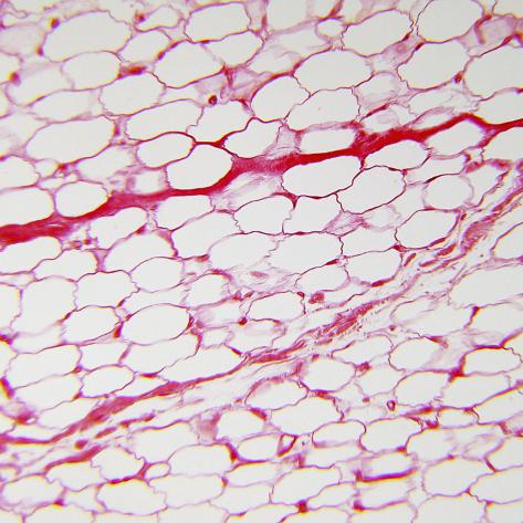 Human skin is a steroidogenic tissue