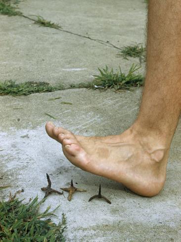 walter-meayers-edwards-man-s-bare-foot-raised-over-colonial-caltrop-shows-its-defensive-use.jpg