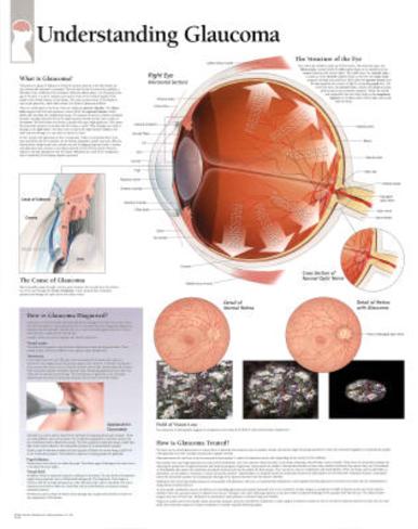 (LAMINATED) UNDERSTANDING LOW BACK PAIN POSTER (66x51cm) ANATOMICAL CHART NEW (LAMINATED) UNDERSTANDING LOW BACK PAIN POSTER (66x51cm) ANATOMICAL CHART NEW