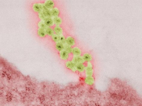 Hiv Tem