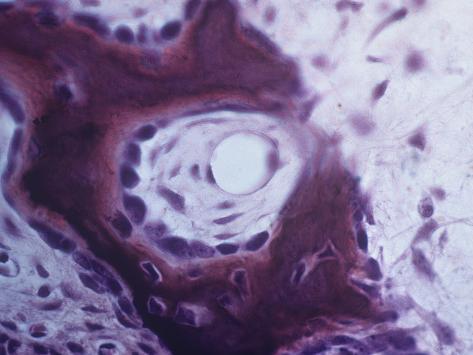 What Are Osteocytes