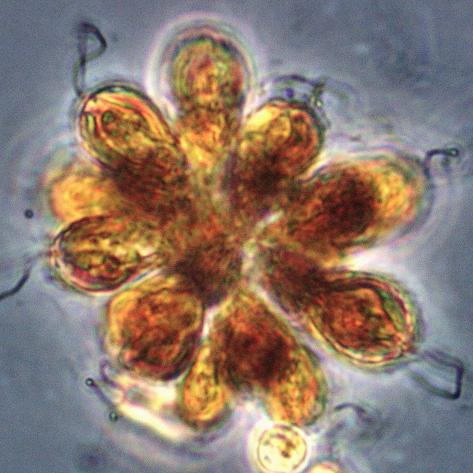 Synura Algae