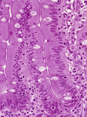 Human Ileum