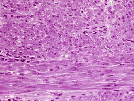 Smooth Muscle Longitudinal