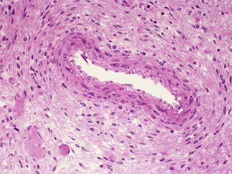 Artery Section
