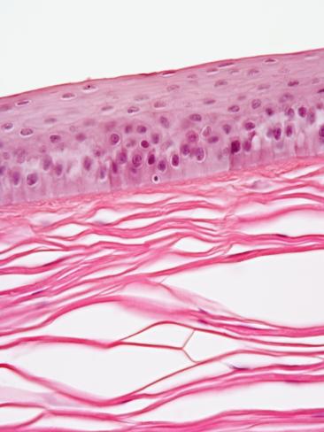 cornea cross section