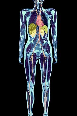 What does a full-body MRI show?