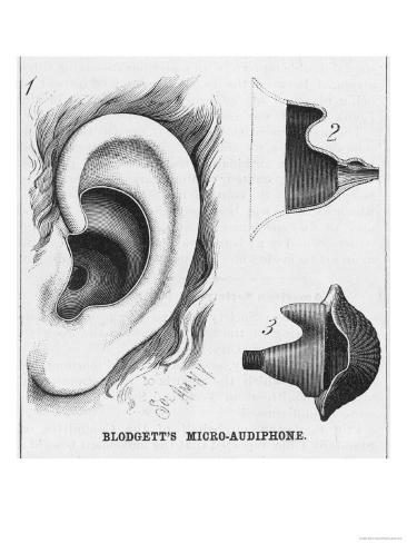 Слуховой Аппарат Аудиофон