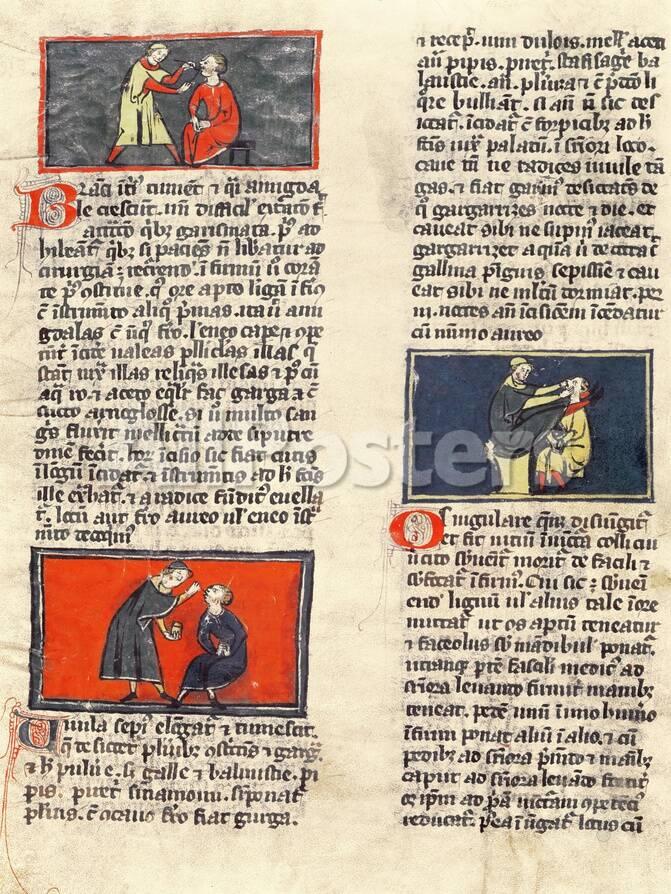 Ms H 89 Fol 16v Dental Surgery From An Edition Of The Book Of Surgery By Rogier De Salerne Giclee Print Allposters Com