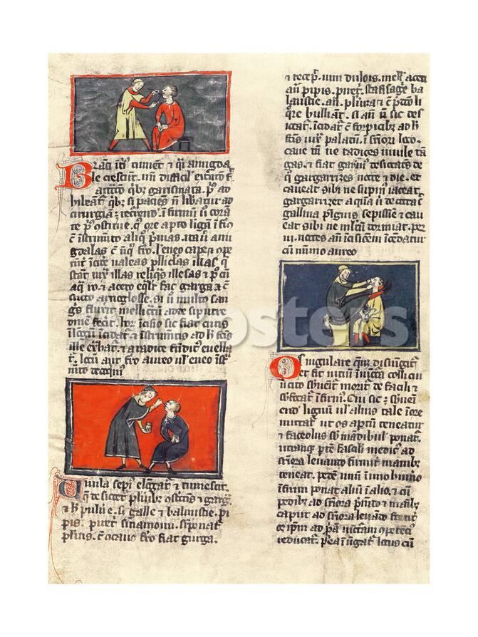 Ms H 89 Fol 16v Dental Surgery From An Edition Of The Book Of Surgery By Rogier De Salerne Giclee Print Allposters Com