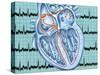 Atrial Fibrillation-John Bavosi-Stretched Canvas