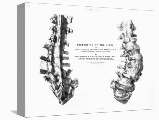 1852 Gideon Mantell Fused Spine Composite-Stewart Stewart-Stretched Canvas