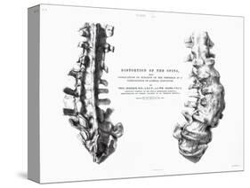 1852 Gideon Mantell Fused Spine Composite-Stewart Stewart-Stretched Canvas