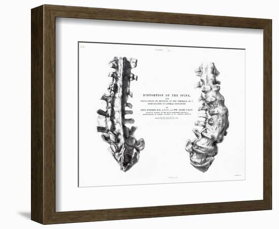 1852 Gideon Mantell Fused Spine Composite-Stewart Stewart-Framed Photographic Print