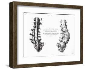 1852 Gideon Mantell Fused Spine Composite-Stewart Stewart-Framed Photographic Print