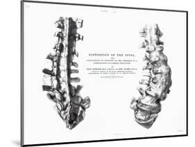 1852 Gideon Mantell Fused Spine Composite-Stewart Stewart-Mounted Photographic Print