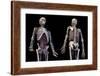 3/4 upper body view of human skeletal and vascular systems, black background.-Leonello Calvetti-Framed Art Print