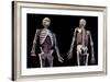 3/4 upper body view of human skeletal and vascular systems, black background.-Leonello Calvetti-Framed Art Print