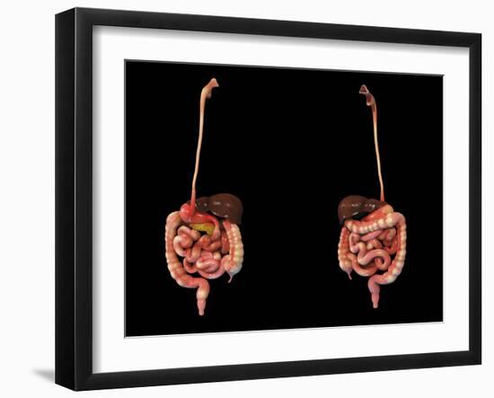 3D Rendering of Human Digestive System-Stocktrek Images-Framed Art Print