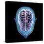 3D rendering of human head and brain with glow, top view on black background.-Hank Grebe-Stretched Canvas