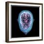 3D rendering of human head and brain with glow, top view on black background.-Hank Grebe-Framed Art Print