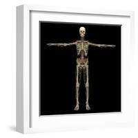 3D Rendering of Human Lymphatic System with Skeleton-Stocktrek Images-Framed Art Print