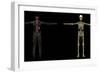 3D Rendering of Human Lymphatic System-Stocktrek Images-Framed Art Print