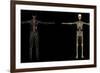 3D Rendering of Human Lymphatic System-Stocktrek Images-Framed Art Print