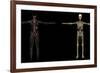 3D Rendering of Human Lymphatic System-Stocktrek Images-Framed Art Print