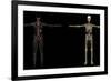 3D Rendering of Human Lymphatic System-Stocktrek Images-Framed Art Print