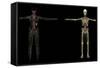 3D Rendering of Human Lymphatic System-Stocktrek Images-Framed Stretched Canvas