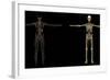 3D Rendering of Human Lymphatic System-Stocktrek Images-Framed Art Print