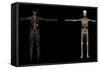 3D Rendering of Human Lymphatic System-Stocktrek Images-Framed Stretched Canvas