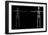 3D Rendering of Human Lymphatic System-Stocktrek Images-Framed Premium Giclee Print
