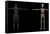 3D Rendering of Human Lymphatic System-Stocktrek Images-Framed Stretched Canvas