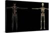 3D Rendering of Human Lymphatic System-Stocktrek Images-Stretched Canvas