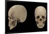 3D Rendering of Human Skull-Stocktrek Images-Framed Art Print