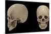 3D Rendering of Human Skull-Stocktrek Images-Stretched Canvas