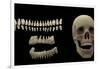 3D Rendering of Human Teeth and Skull-Stocktrek Images-Framed Art Print