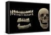 3D Rendering of Human Teeth and Skull-Stocktrek Images-Framed Stretched Canvas