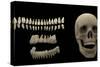 3D Rendering of Human Teeth and Skull-Stocktrek Images-Stretched Canvas