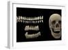 3D Rendering of Human Teeth and Skull-Stocktrek Images-Framed Premium Giclee Print