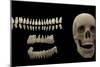 3D Rendering of Human Teeth and Skull-Stocktrek Images-Mounted Premium Giclee Print