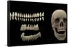 3D Rendering of Human Teeth and Skull-Stocktrek Images-Framed Stretched Canvas