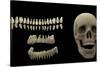 3D Rendering of Human Teeth and Skull-Stocktrek Images-Stretched Canvas