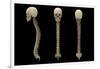 3D Rendering of Human Vertebral Column with Skull-Stocktrek Images-Framed Art Print