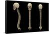 3D Rendering of Human Vertebral Column with Skull-Stocktrek Images-Framed Stretched Canvas